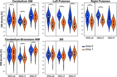 Combined regional T1w/T2w ratio and voxel-based morphometry in multiple system atrophy: A follow-up study